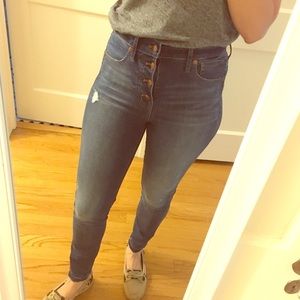 Madewell 10” high rise button fly skinny jeans